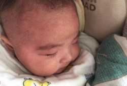 孩子湿疹吃瓜能行吗,西瓜，真的能缓解症状吗？